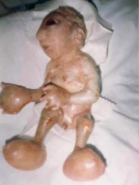 NH #621:  Depleted Uranium Weapons = Nuclear War in Ukraine - Dr. Helen Caldicott