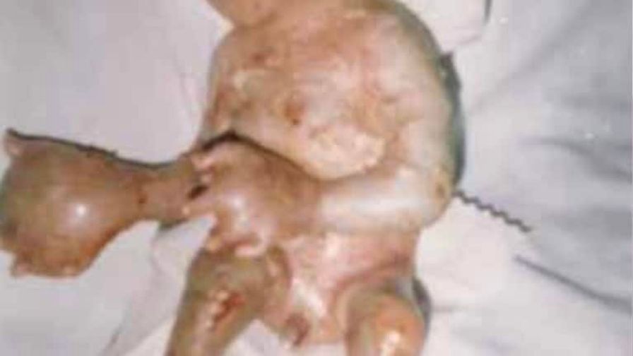 NH #621: Depleted Uranium Weapons = Nuclear War in Ukraine - Dr. Helen Caldicott