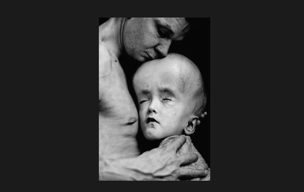 NH #519: Chernobyl Lies, Cover-Up by World Health Organization