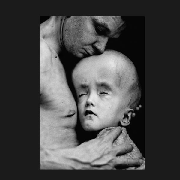 NH #519: Chernobyl Lies, Cover-Up by World Health Organization