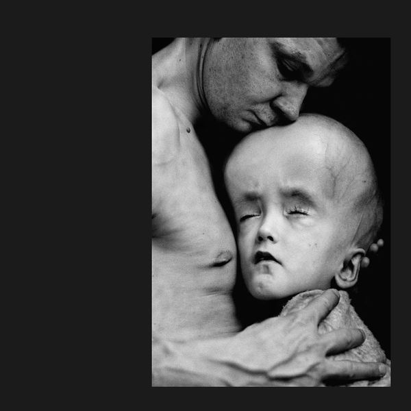 NH #519: Chernobyl Lies, Cover-Up by World Health Organization