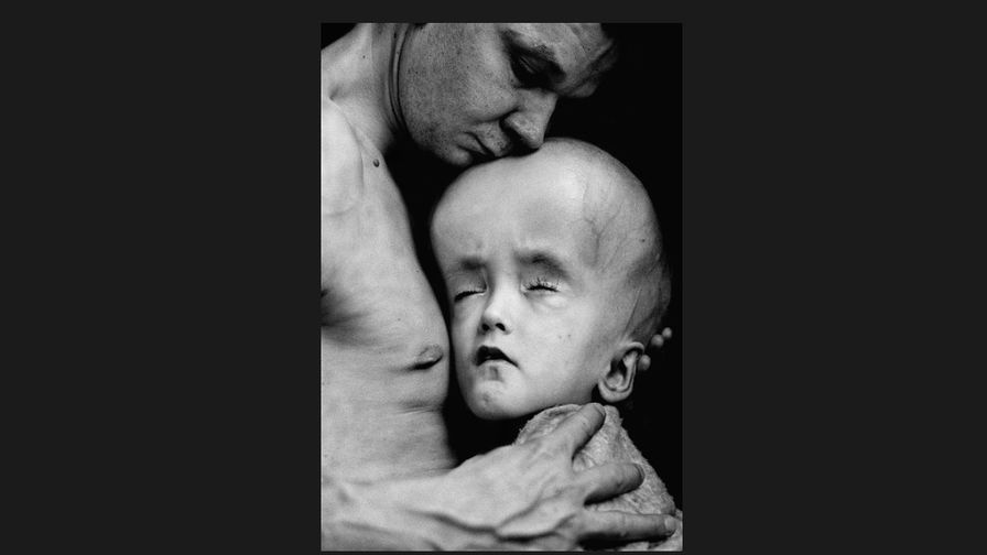 NH #519: Chernobyl Lies, Cover-Up by World Health Organization