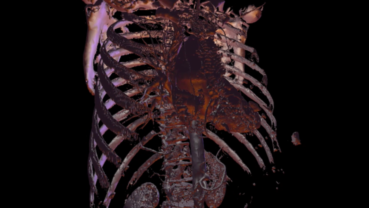 Human Body Visualization Workshop