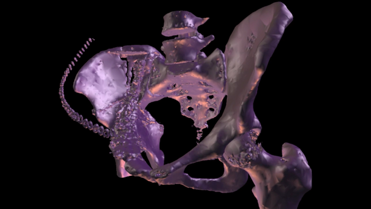 Human Body Visualization Workshop