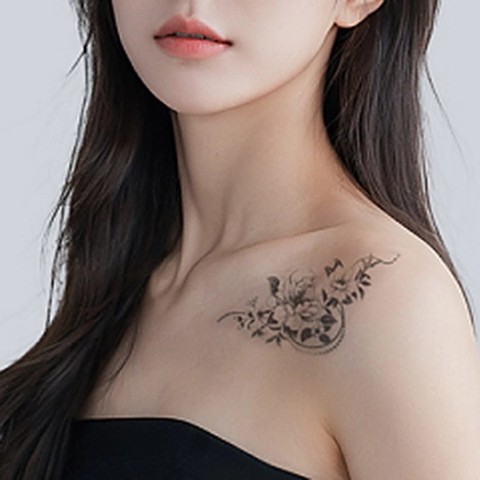 문신 제거