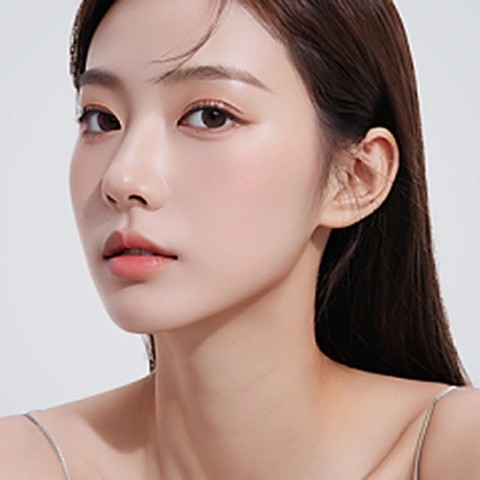 트임성형
