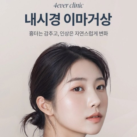 Forehead/Brow Lift