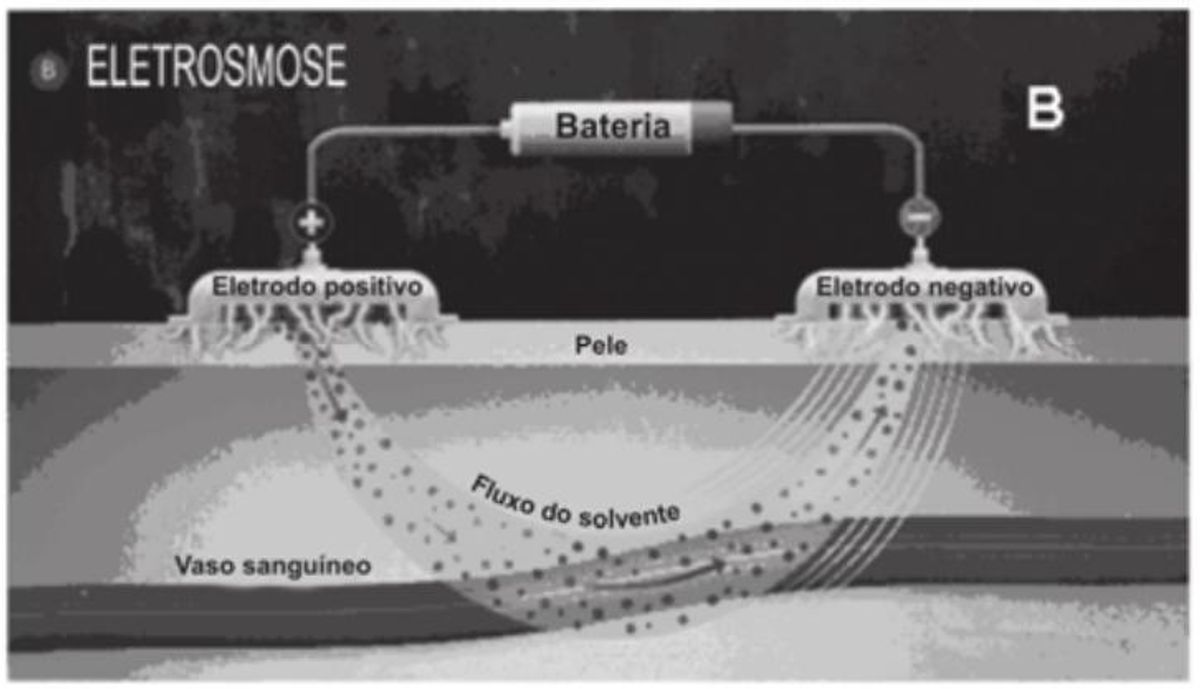 Questão 22 - ENEM 2009 - Fisiologia humana