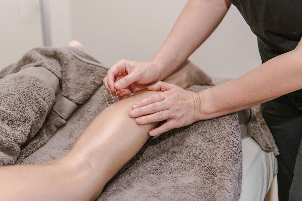 Dry Needling on a client's lower leg
