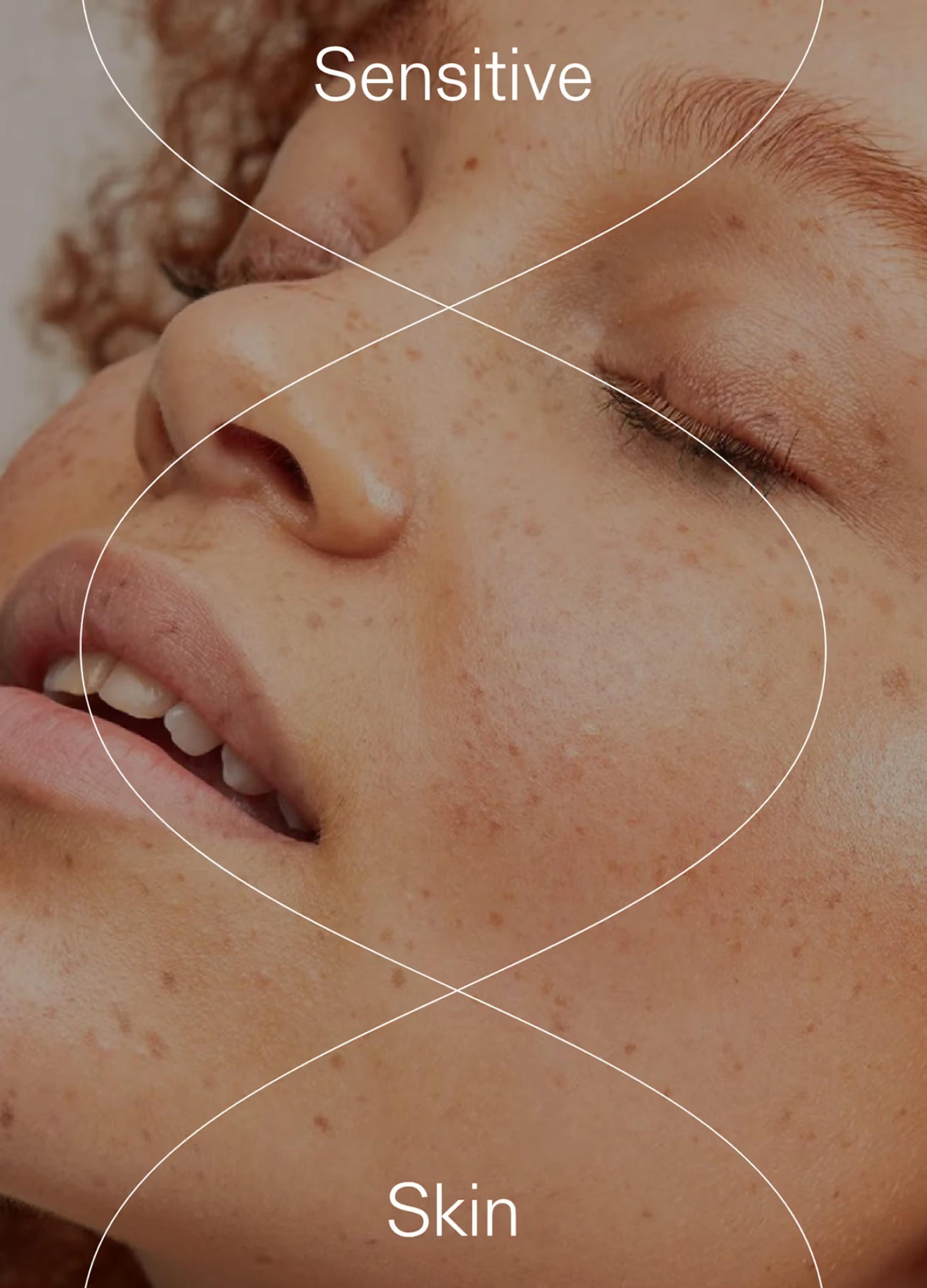 Close-up of a woman with freckles and naturally textured skin, featuring the words "Sensitive" and "Skin."