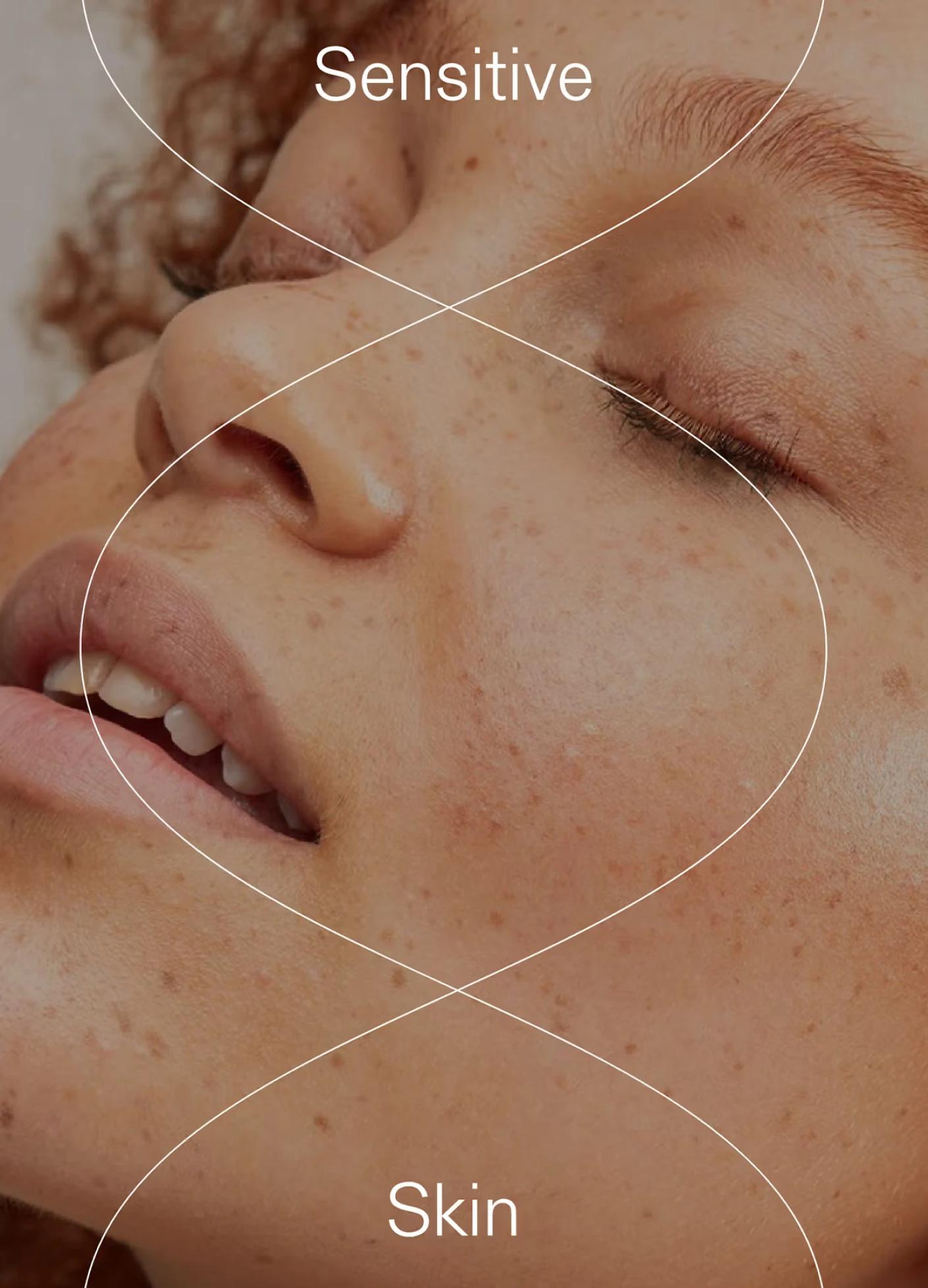 Close-up of a woman with freckles and naturally textured skin, featuring the words "Sensitive" and "Skin."