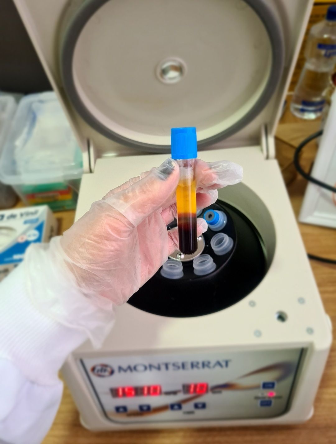 Frasco sendo retirado da centrífuga, mostrando o plasma (líquido amarelado) sendo separado