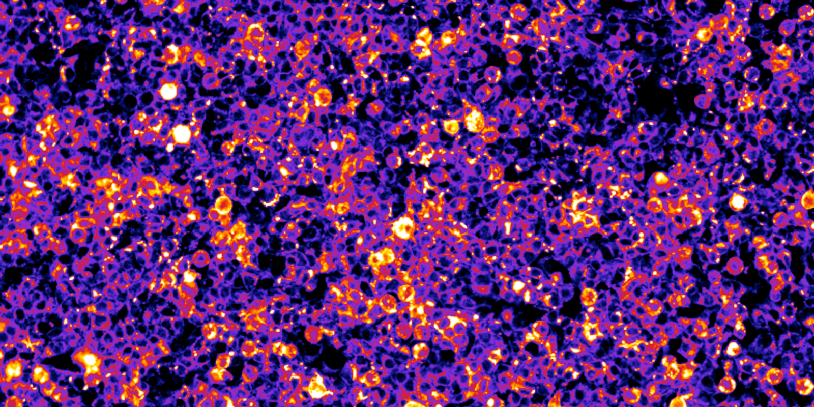 Our investment in BioLoomics — evolving better antibody therapeutics