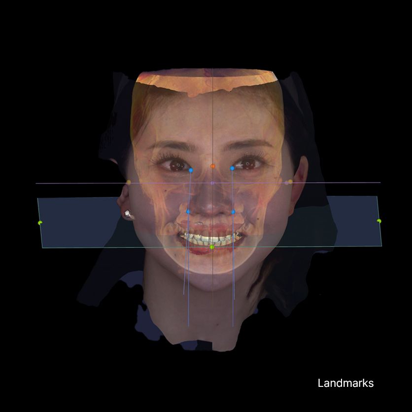 RAY - The Future of Face-Driven Dentistry