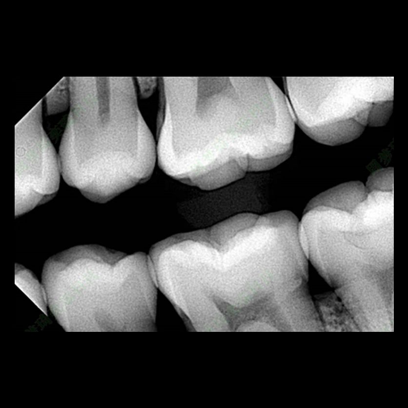 RAY - The Future of Face-Driven Dentistry