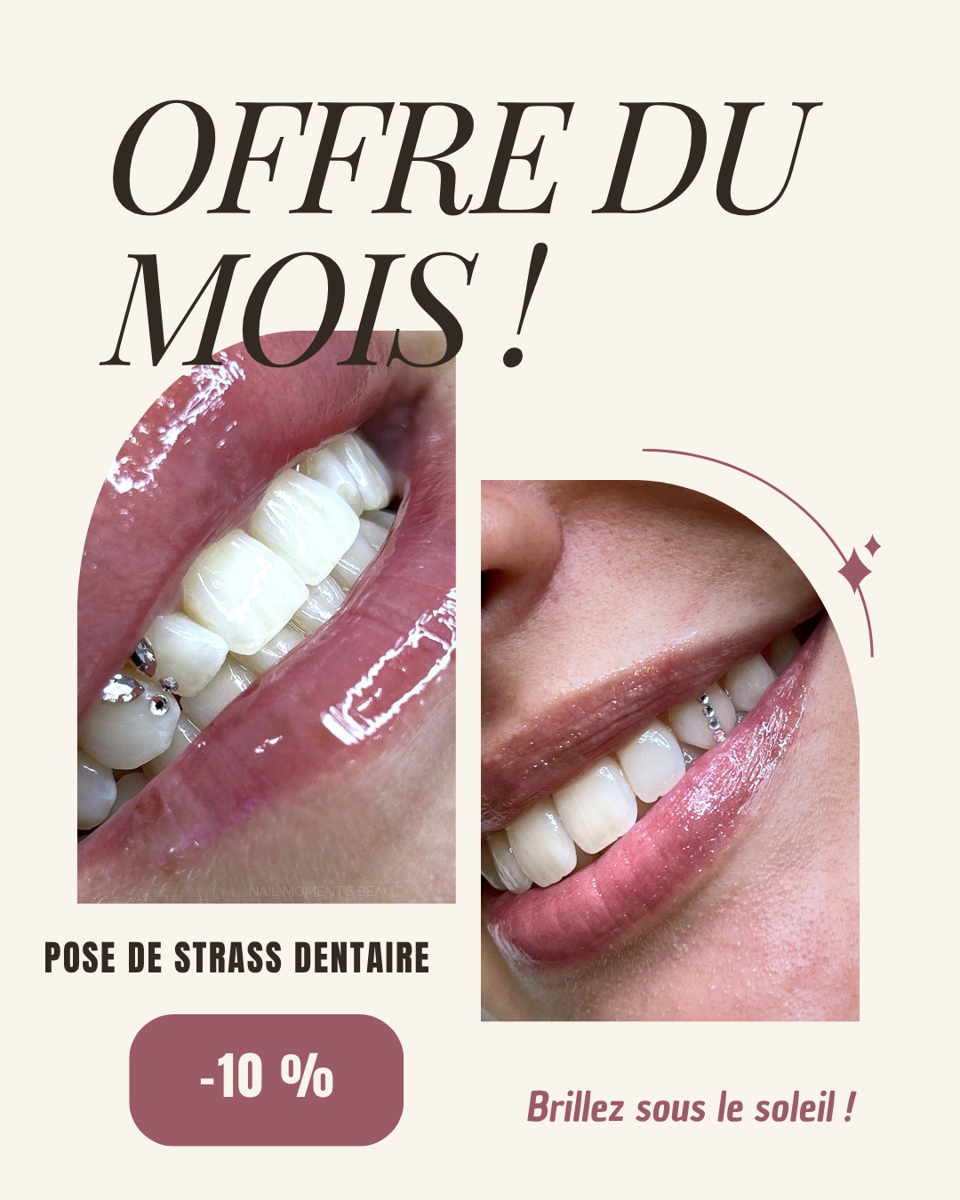 Offre du mois - Pose de strass dentaire -10%