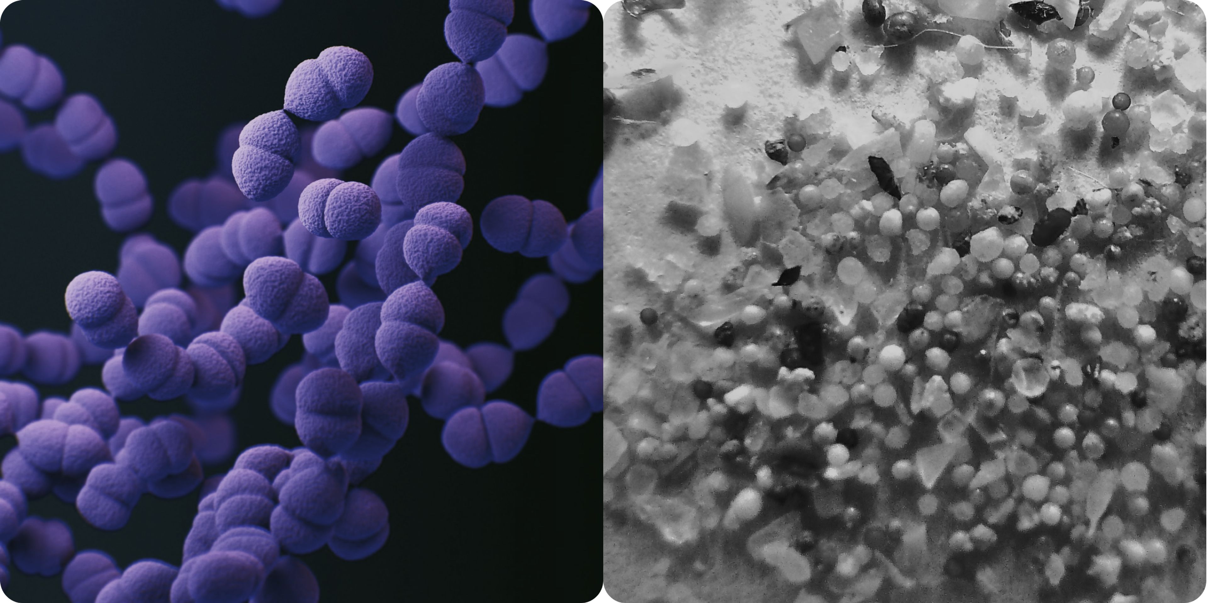 Microplastics ans git bacteria