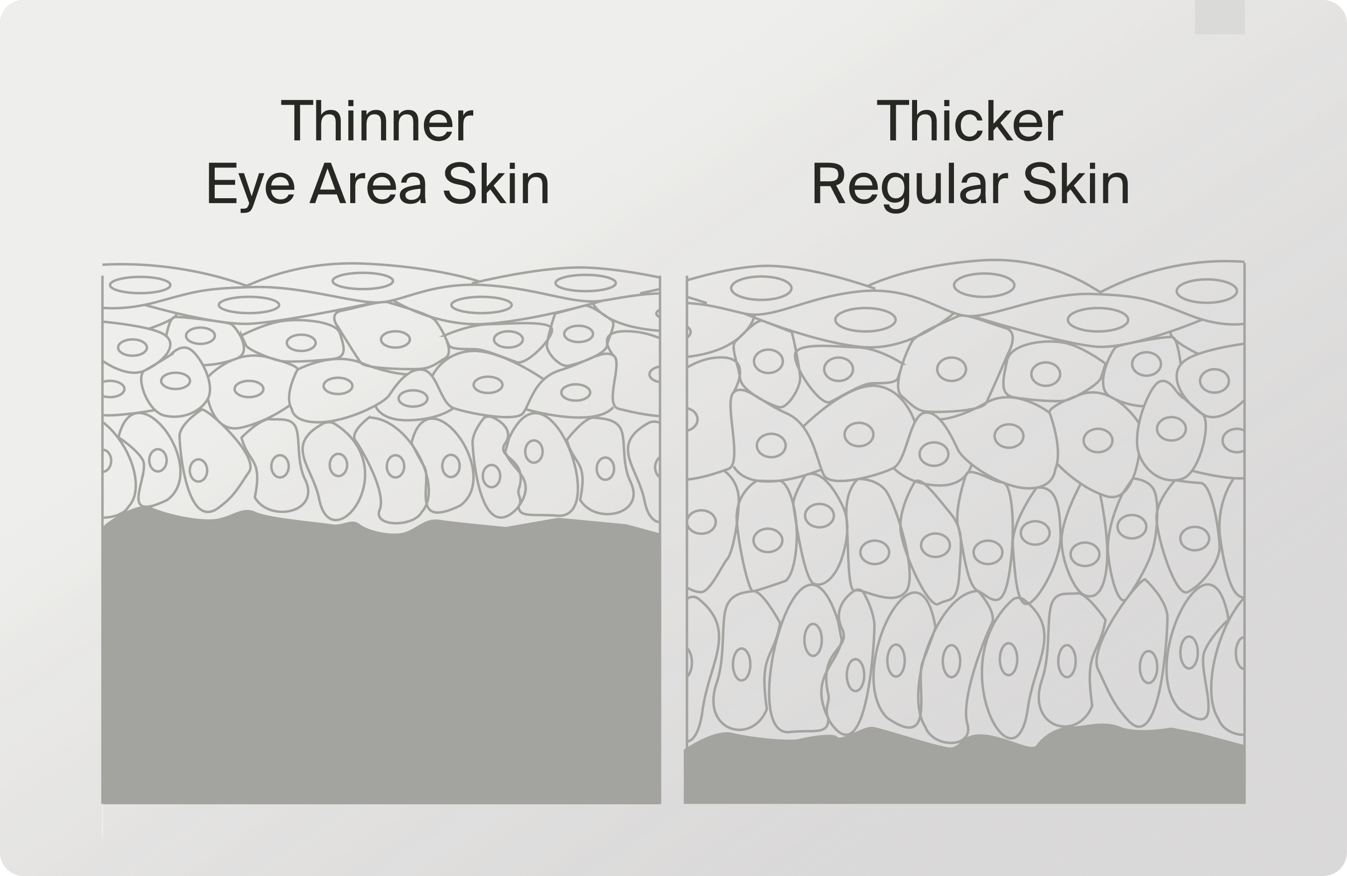 Thinner Eye Area skin vs Thicker Regular Skin
