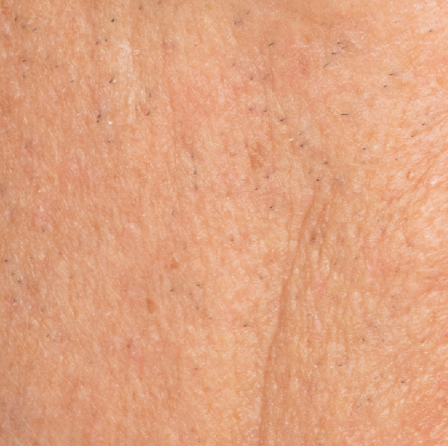 After Dewy Cream
