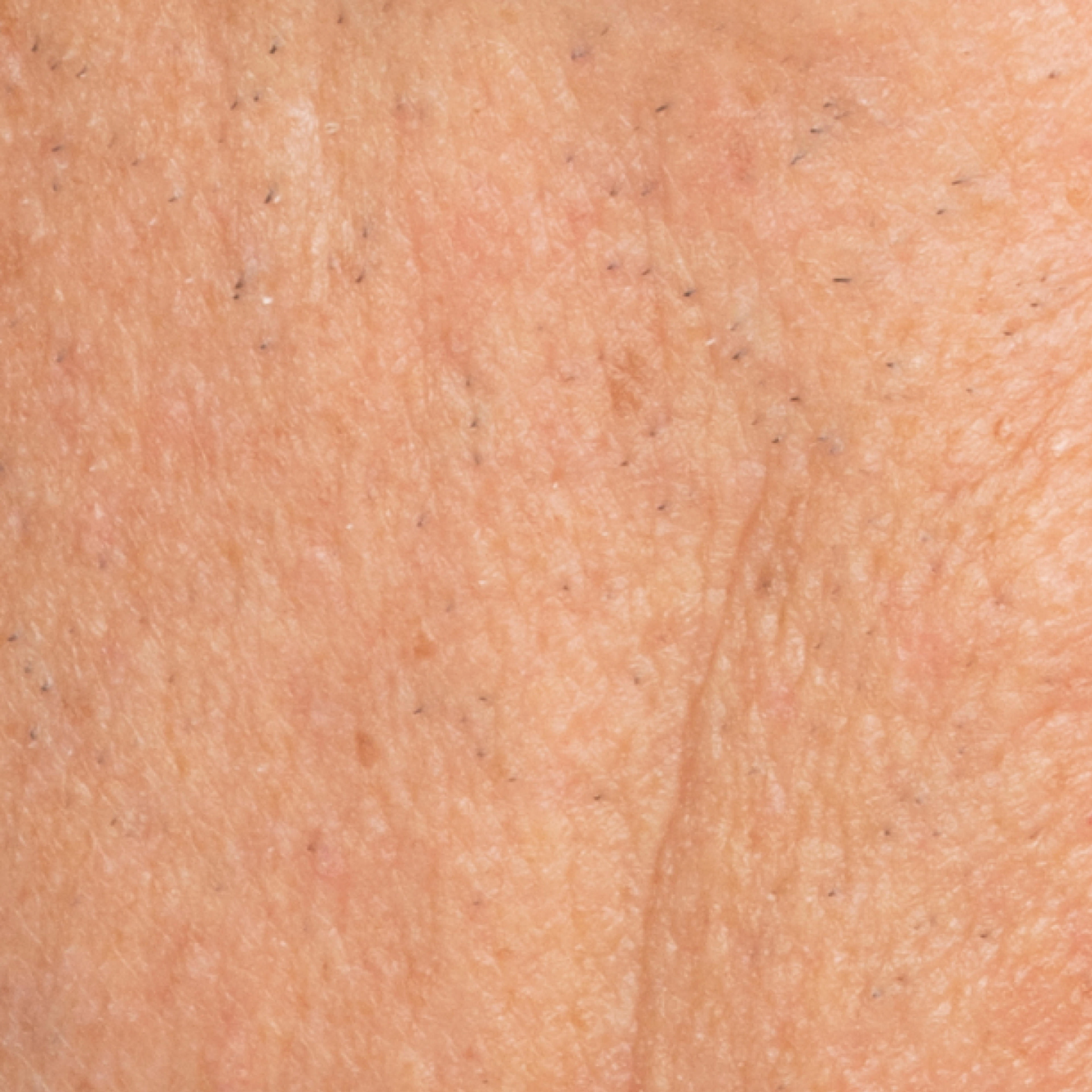 After Dewy Cream