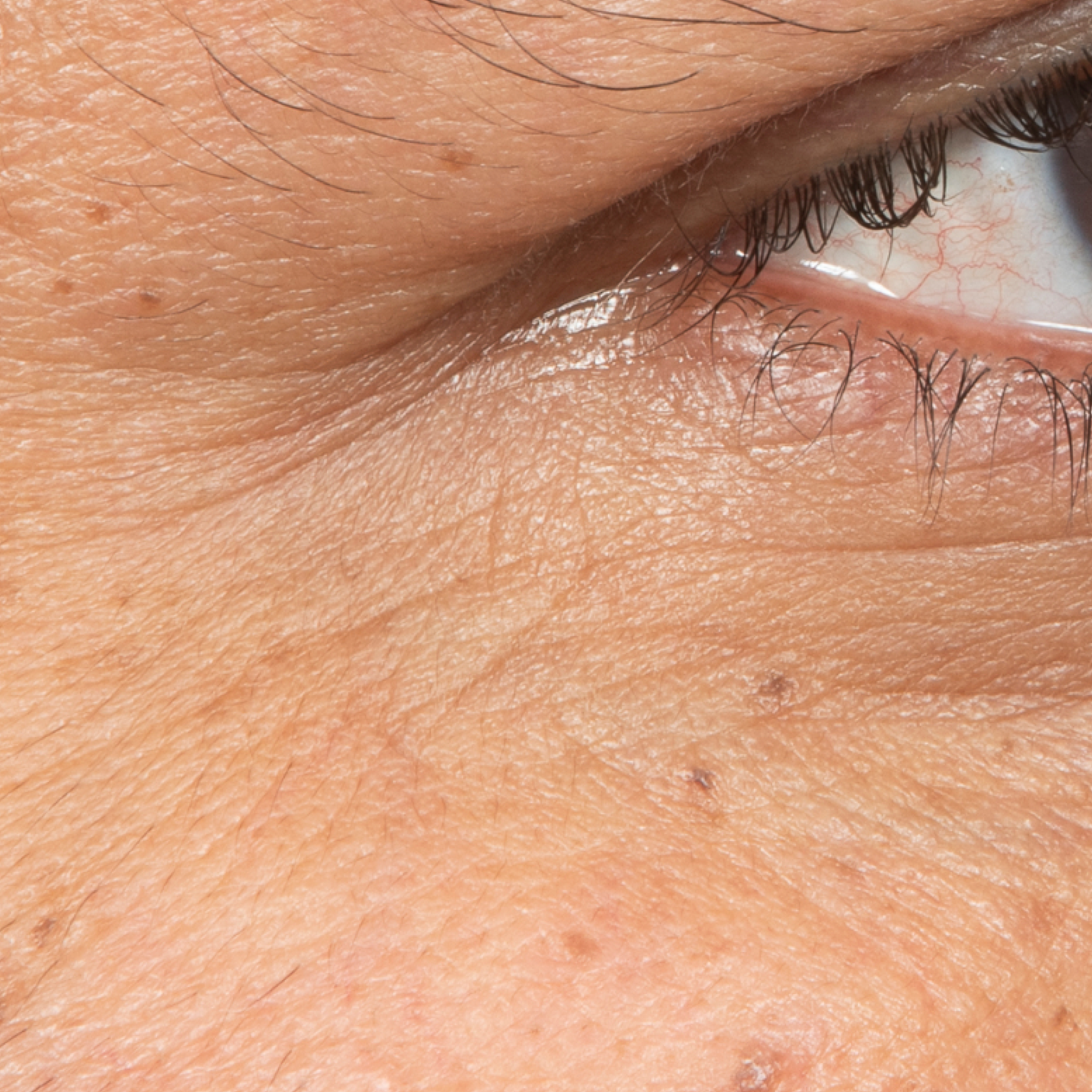Before Eye Cream