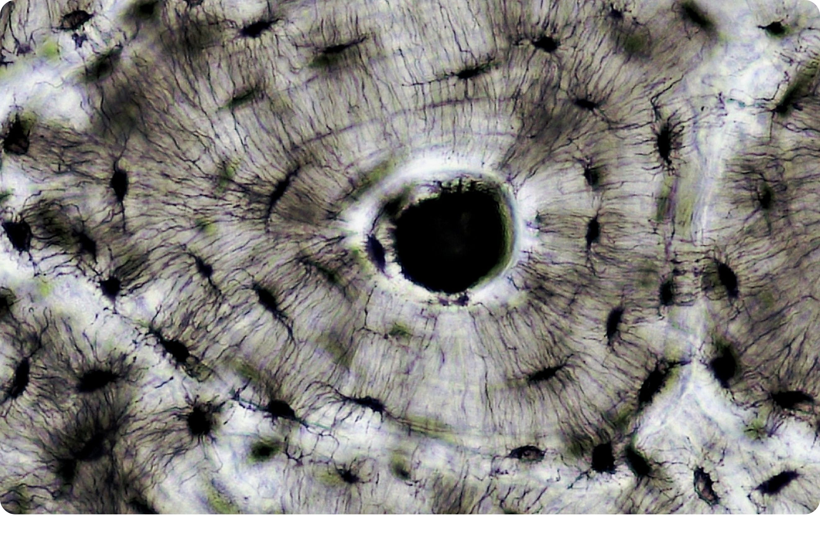 Bone tissue
