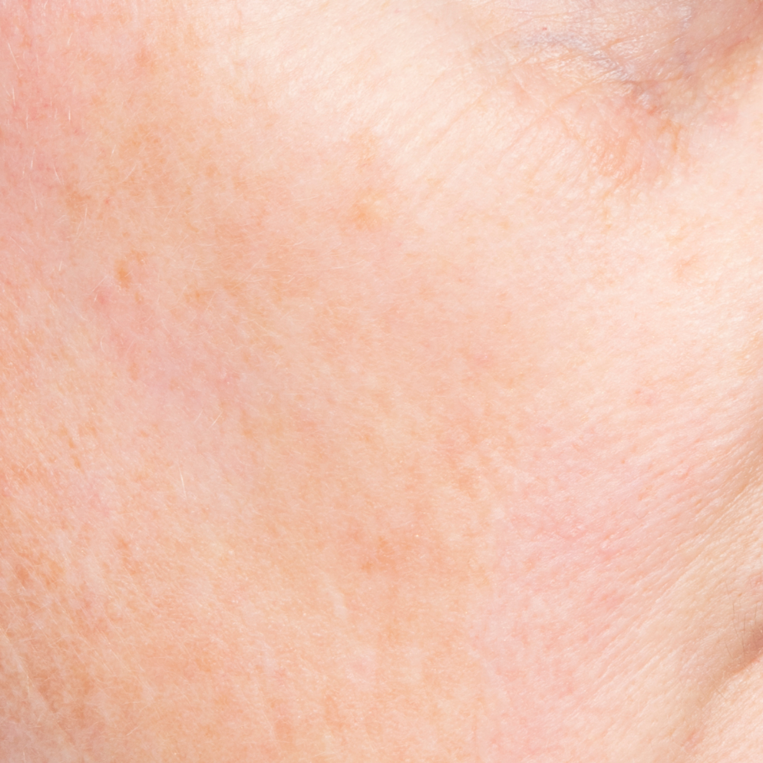 Serum Before