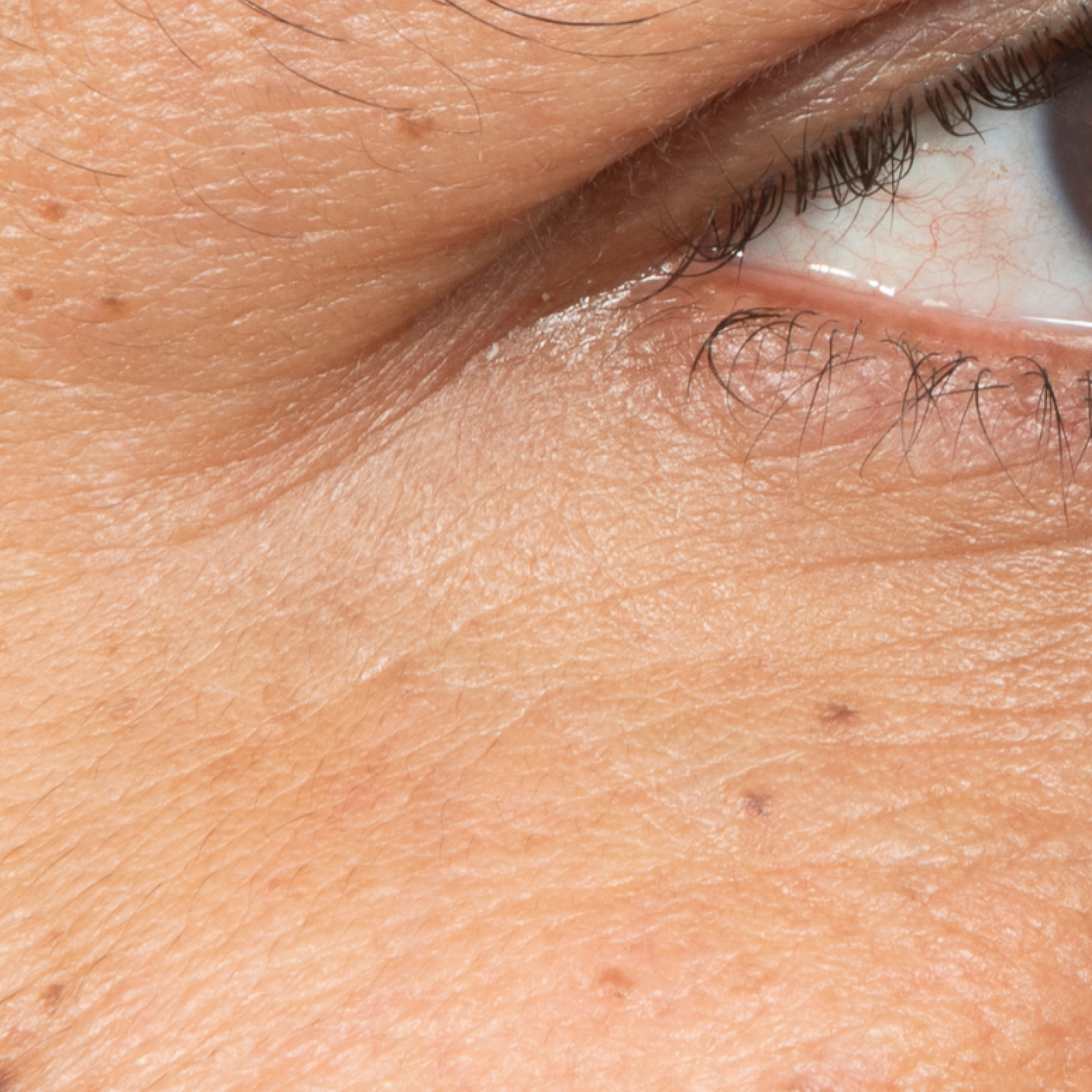 After Eye Cream