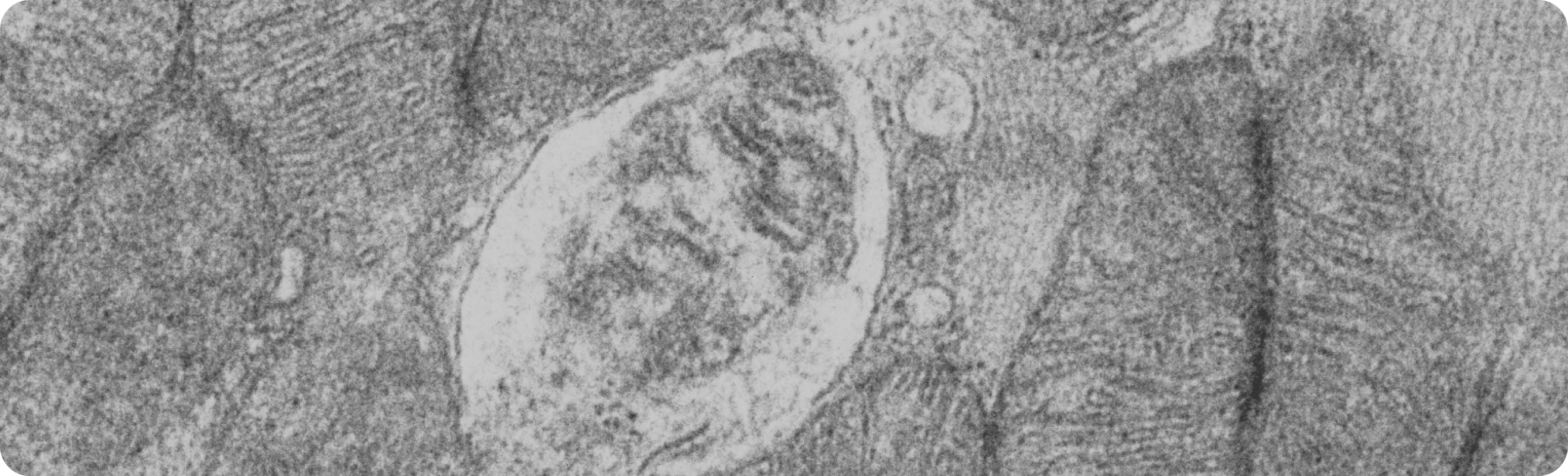 Mitophagy event captured in an electron microscope.