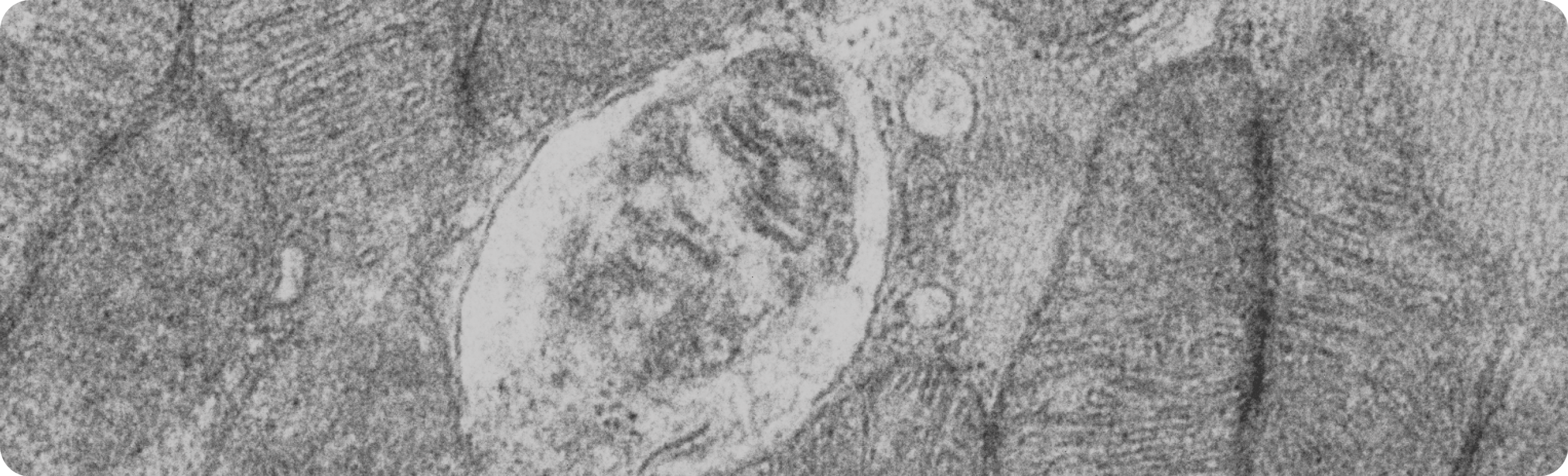 Mitophagy event captured in an electron microscope.