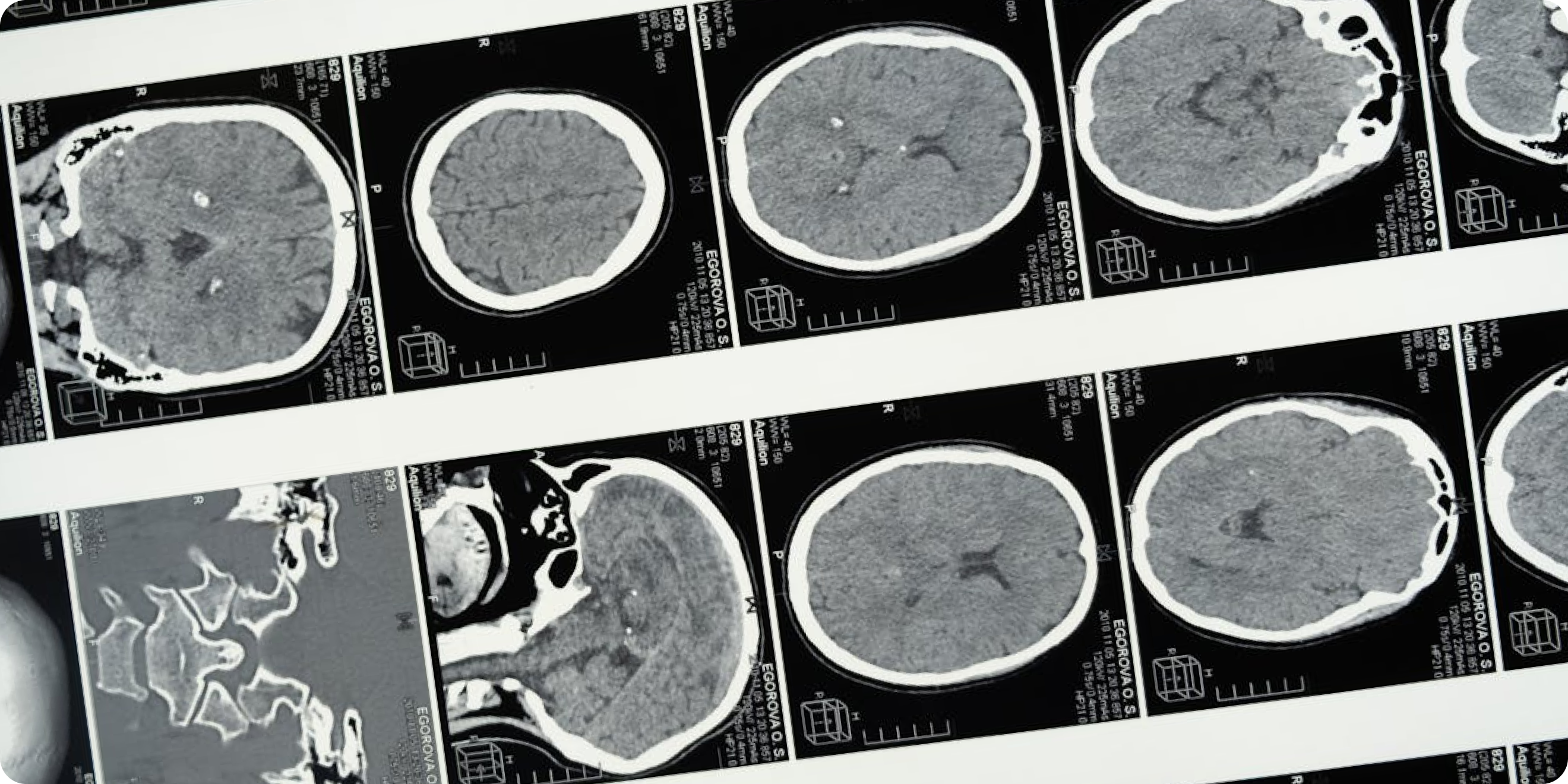 Brain scans