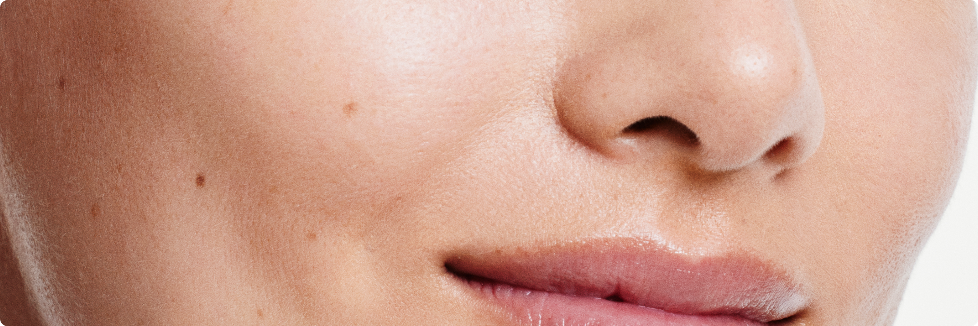 Skin close-up