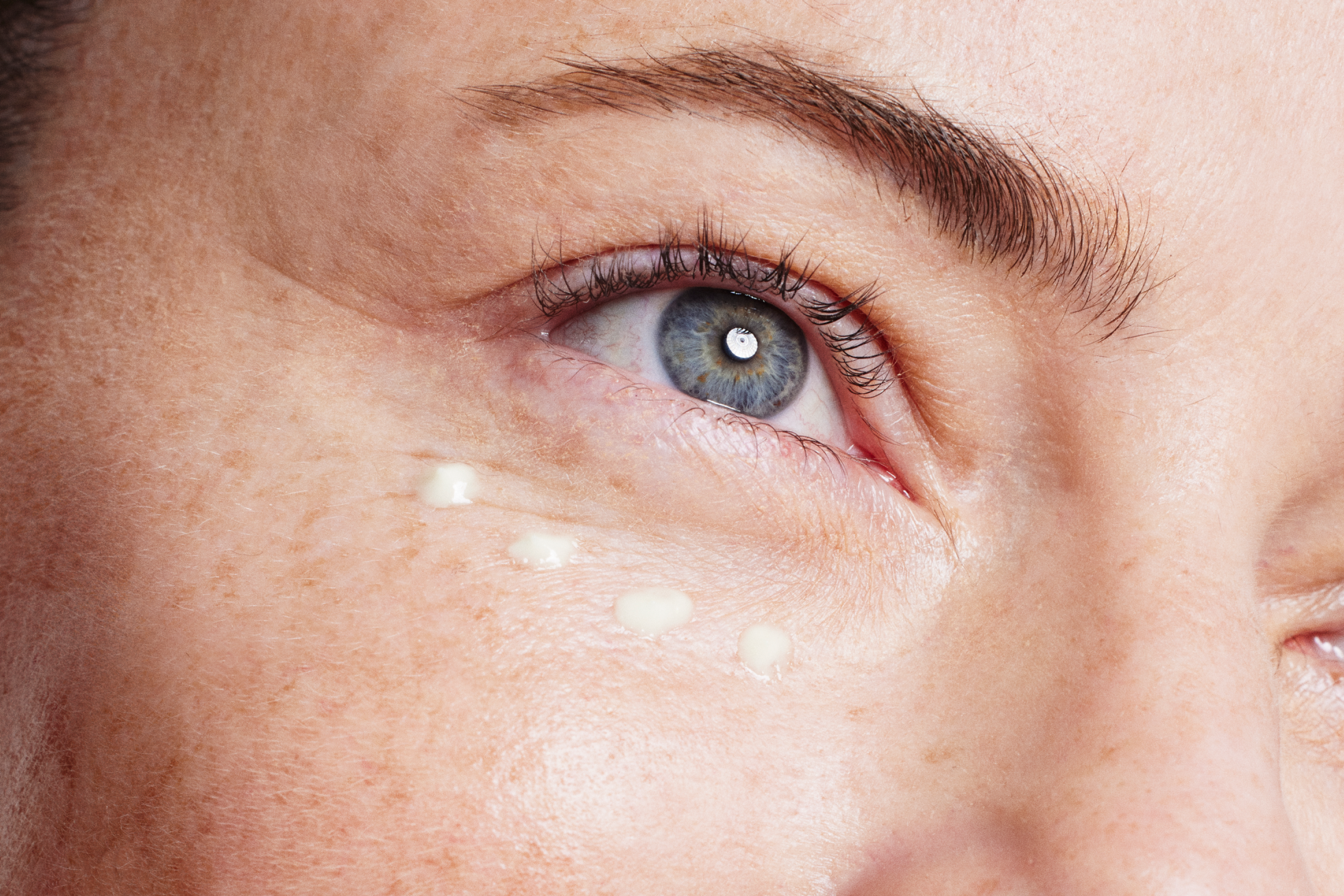 Detail of woman's eye with skin health product