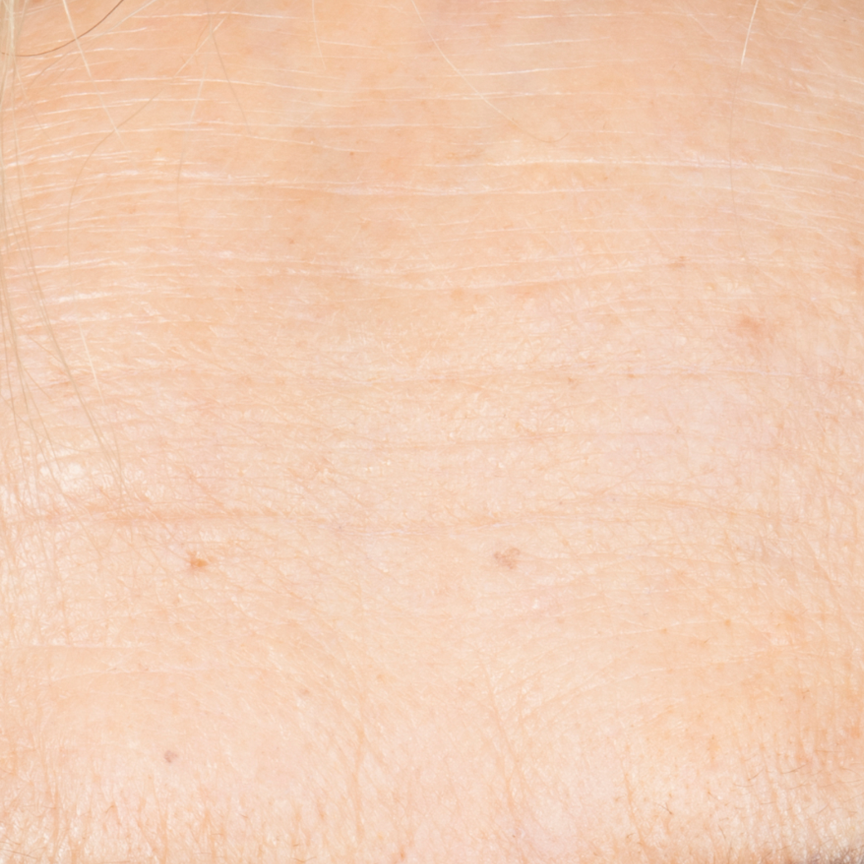 Serum After