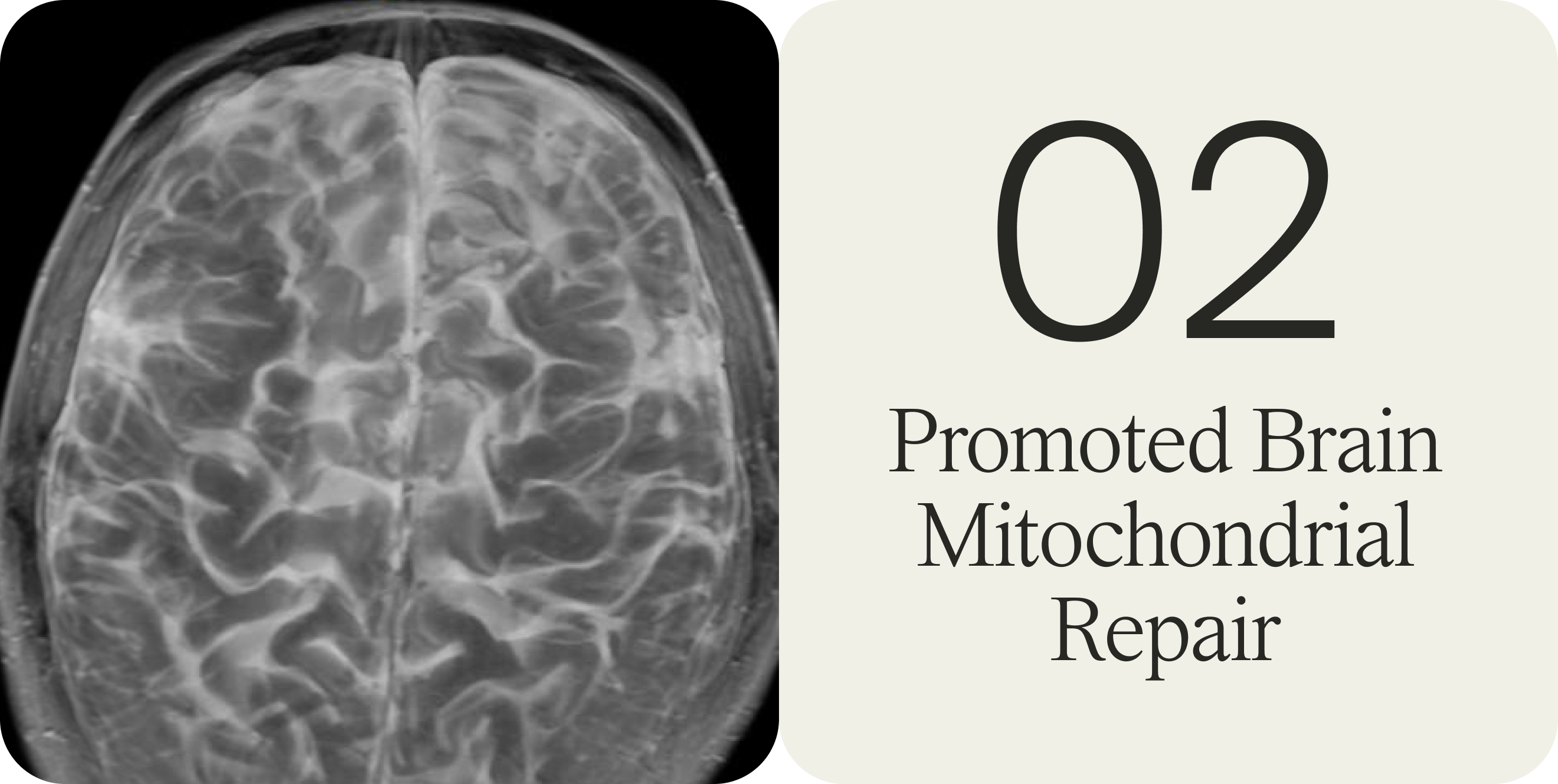 Urolithin A Promoted Brain Mitochondrial Repair