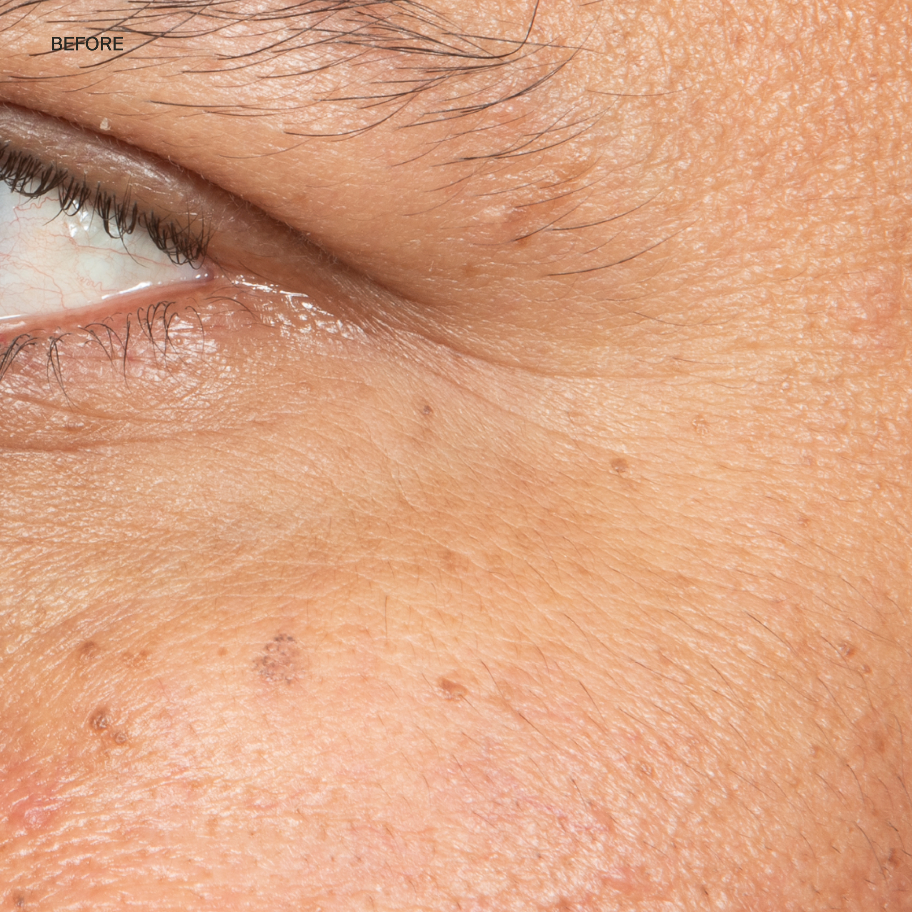 Before Eye Cream