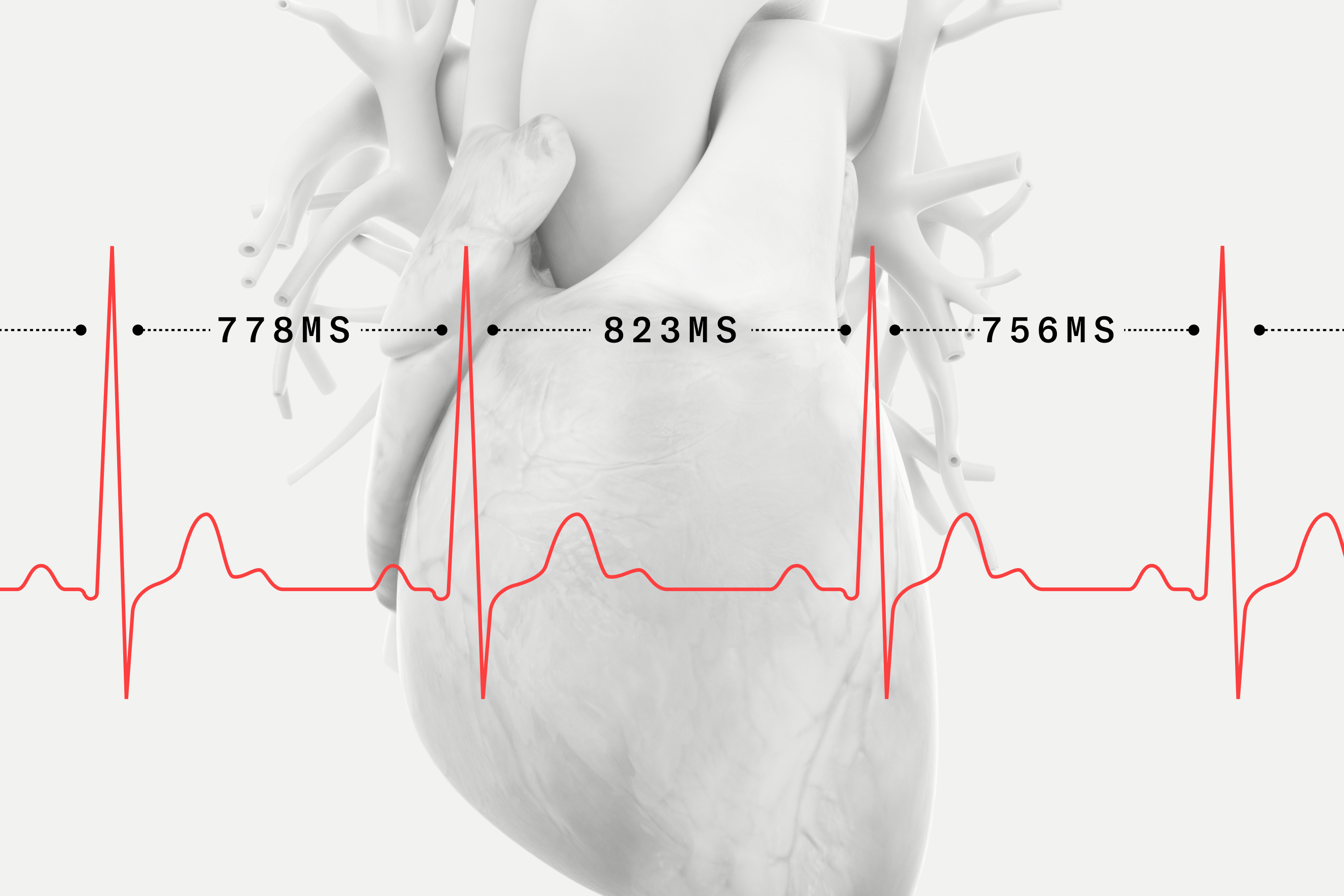 Heart Rate Variability