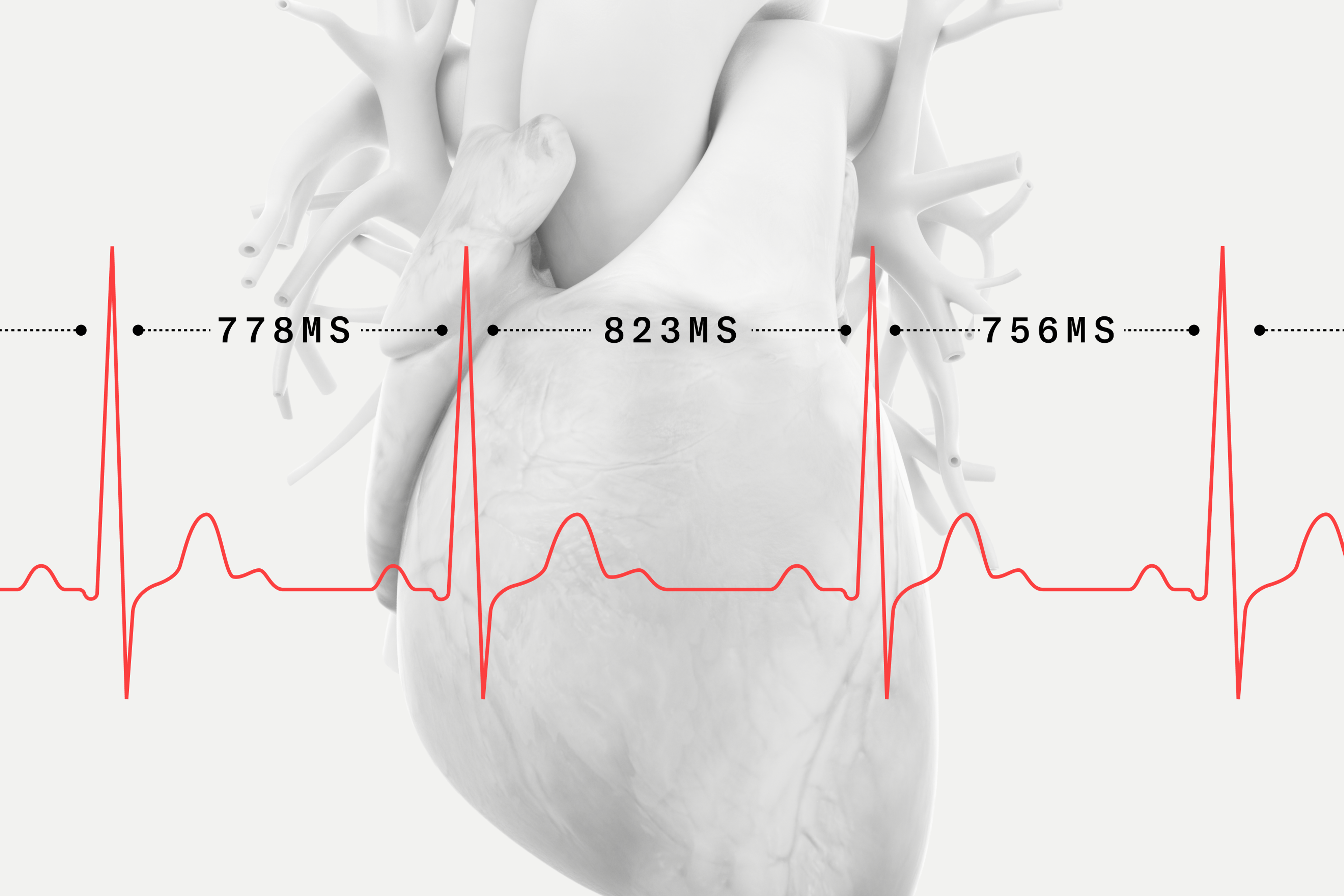 Heart Rate Variability