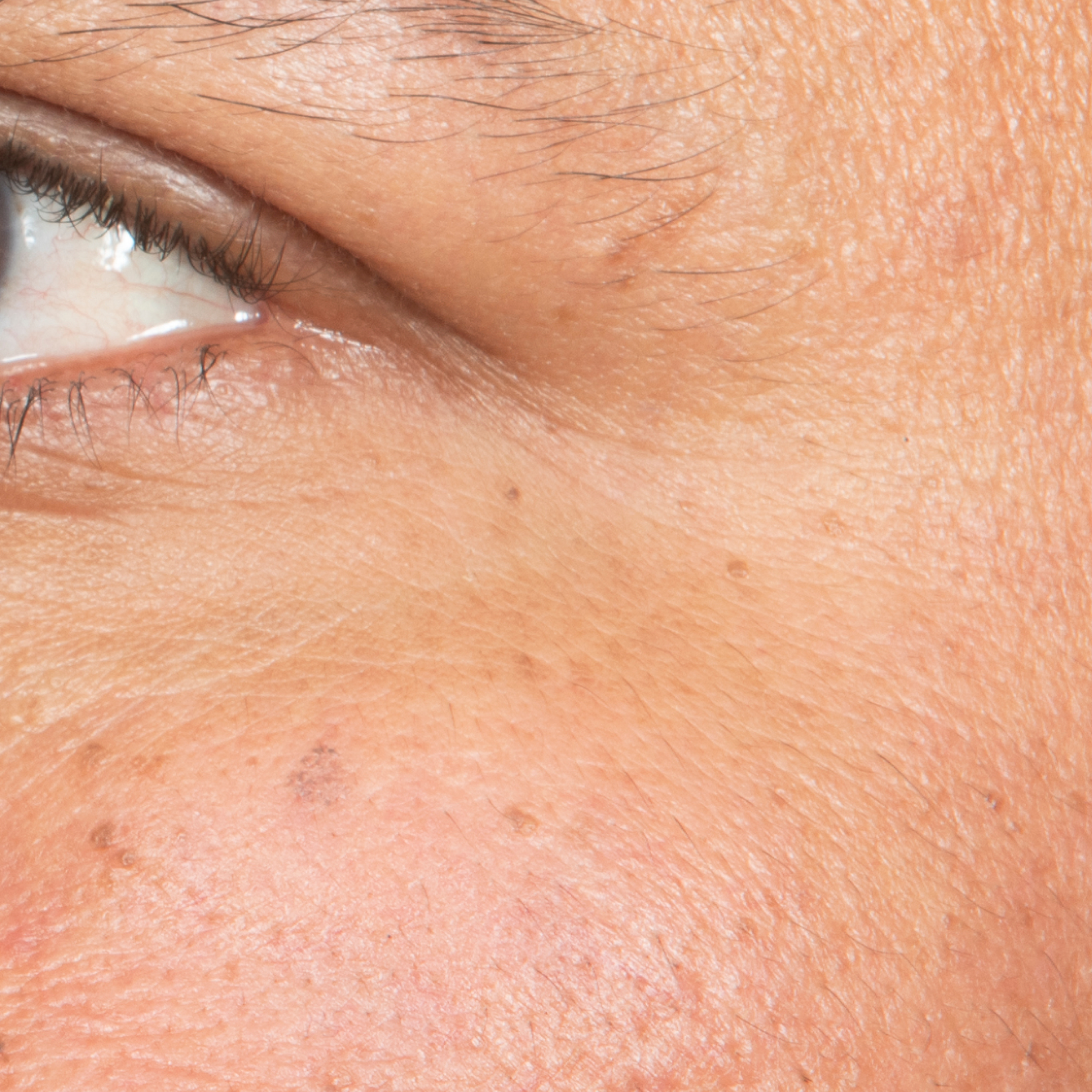 After Eye Cream