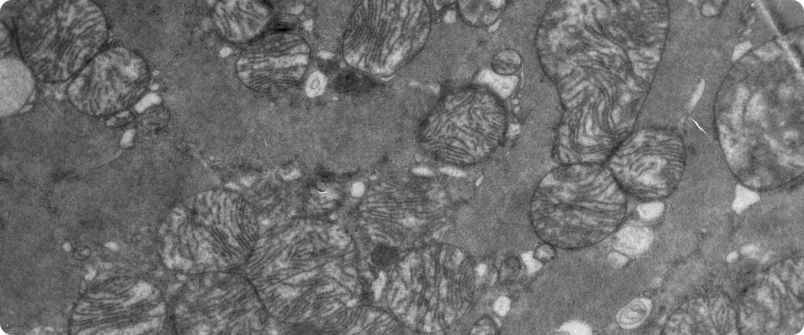 mitochondria