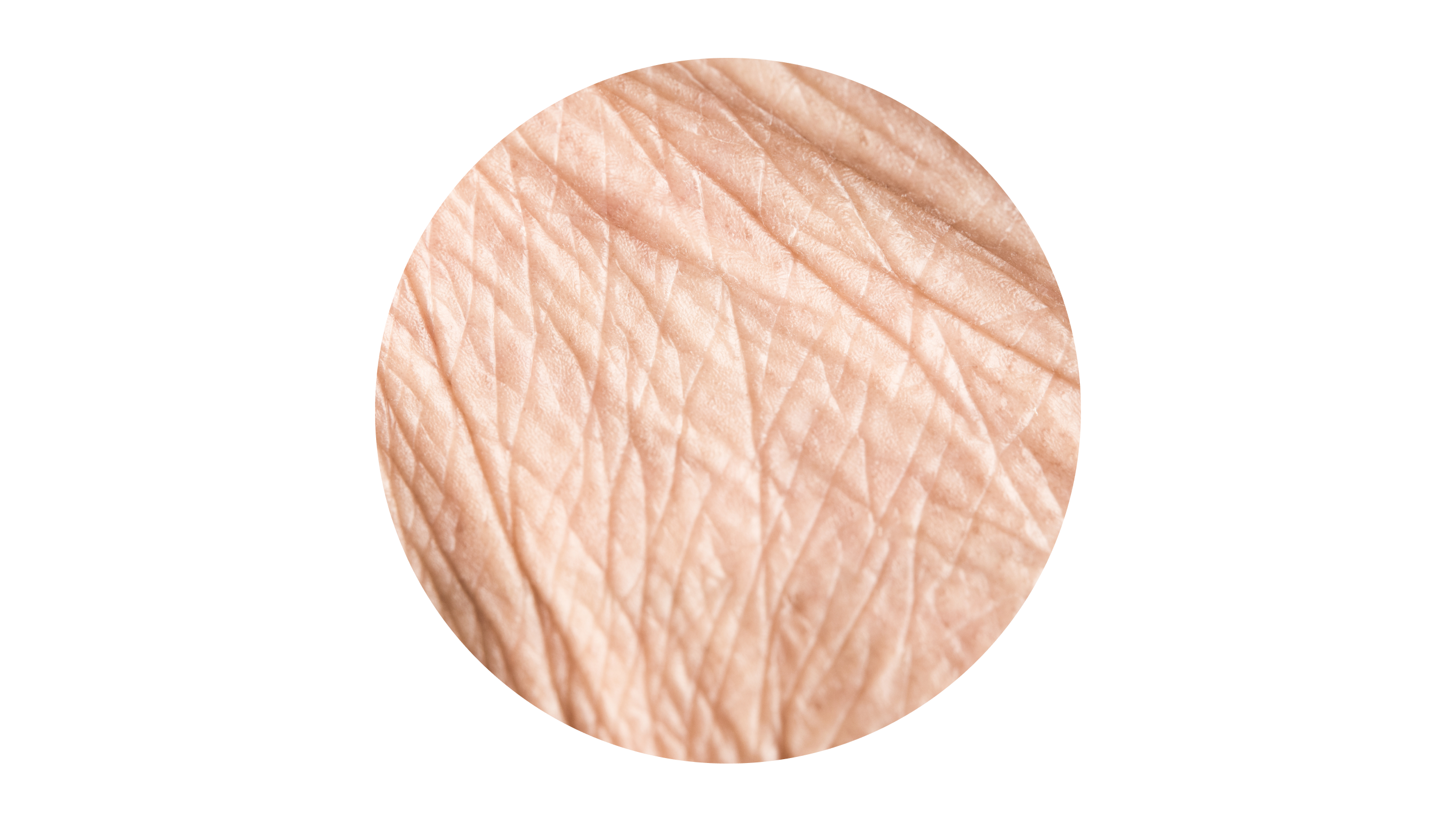 Aging Skin