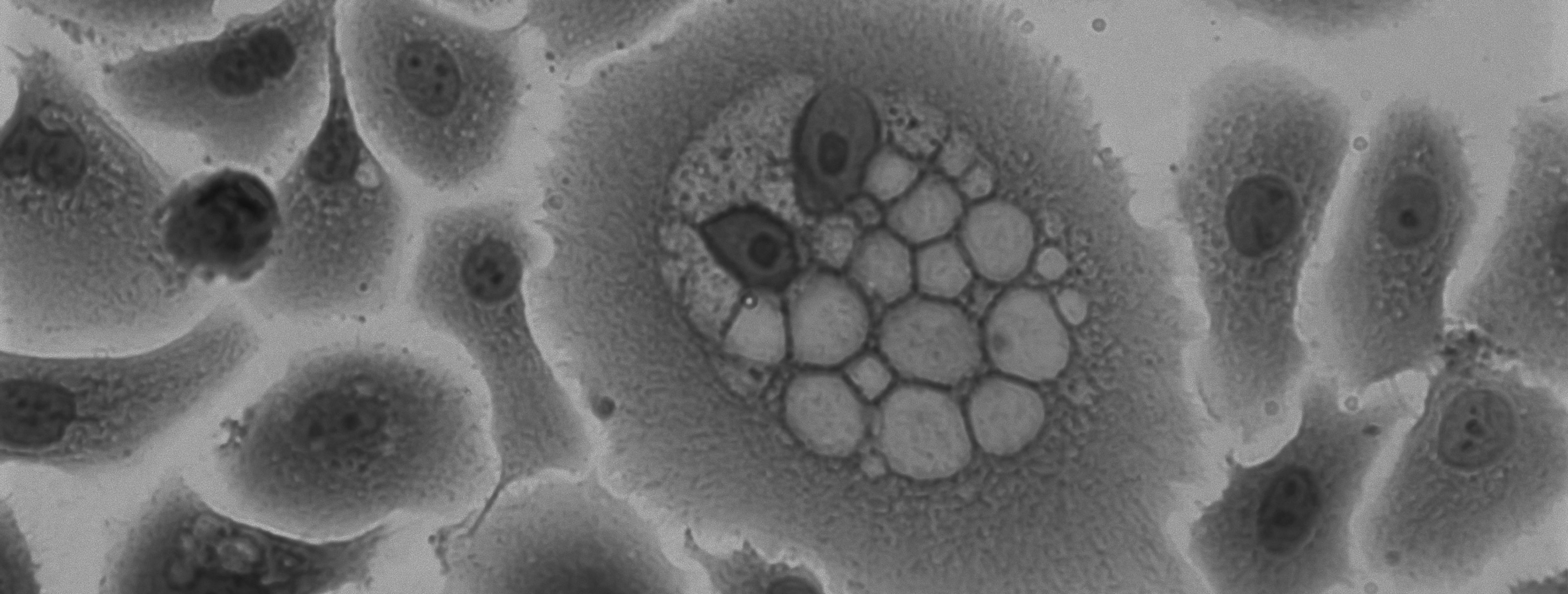t cells