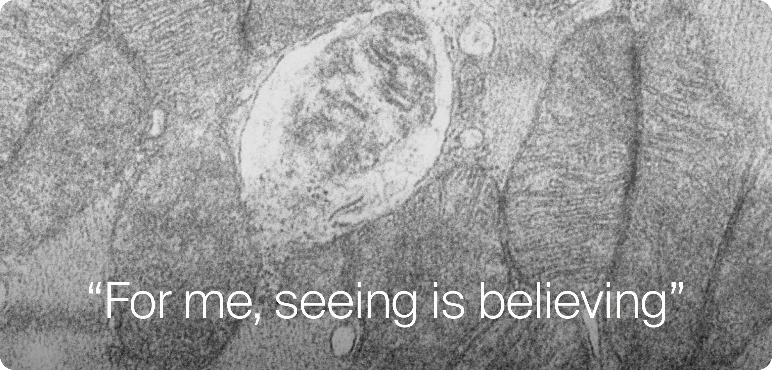 Seeing is believing - Mitochondria image