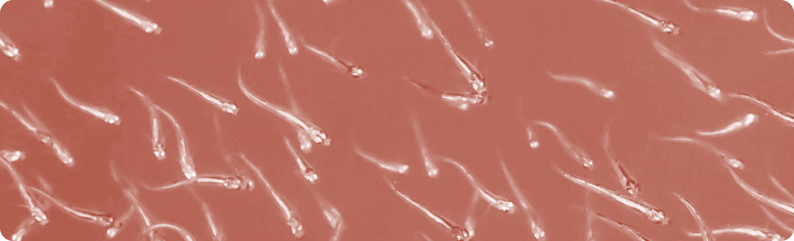 mitochondria and sperm health