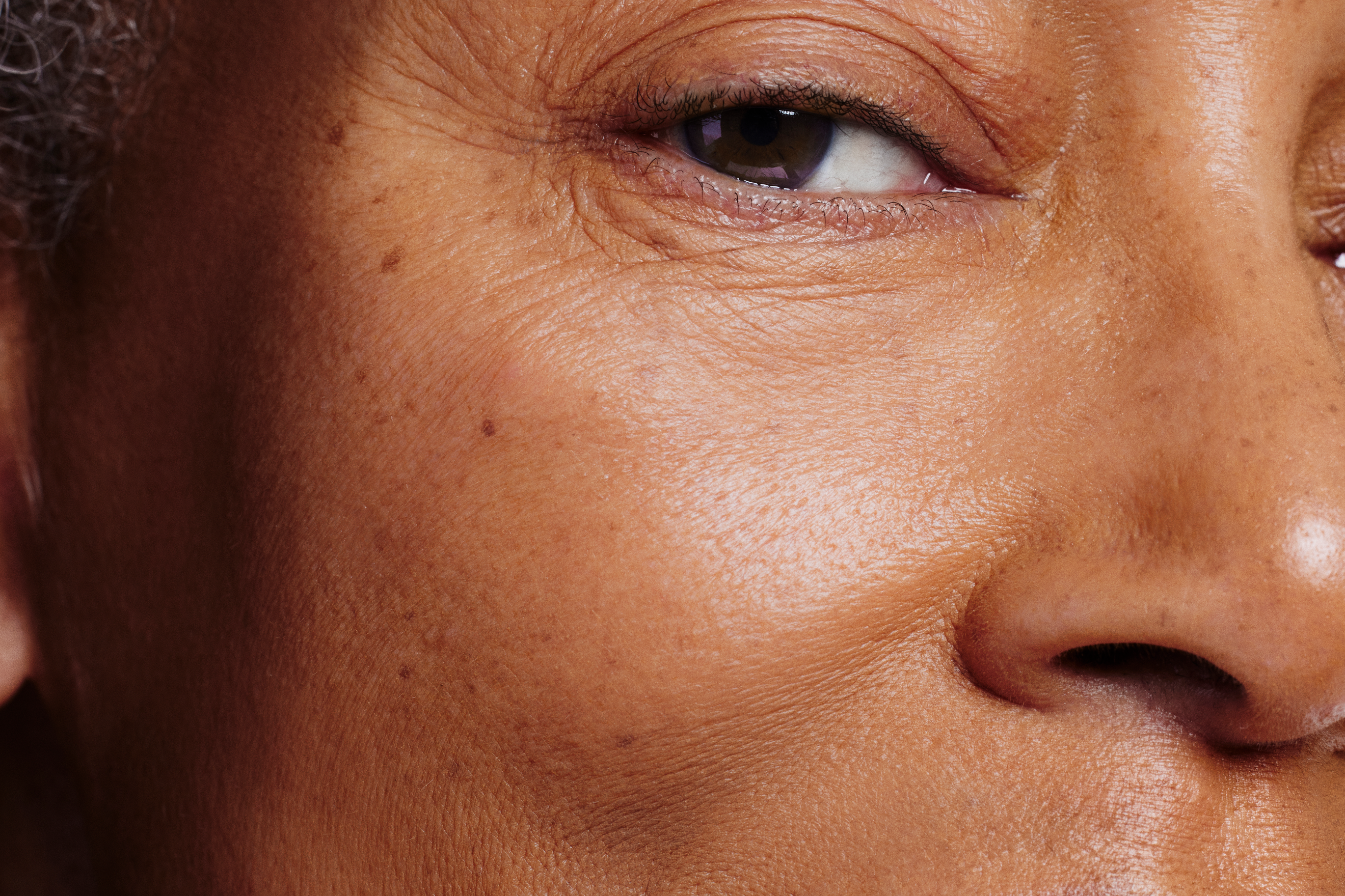 Skin Close Up