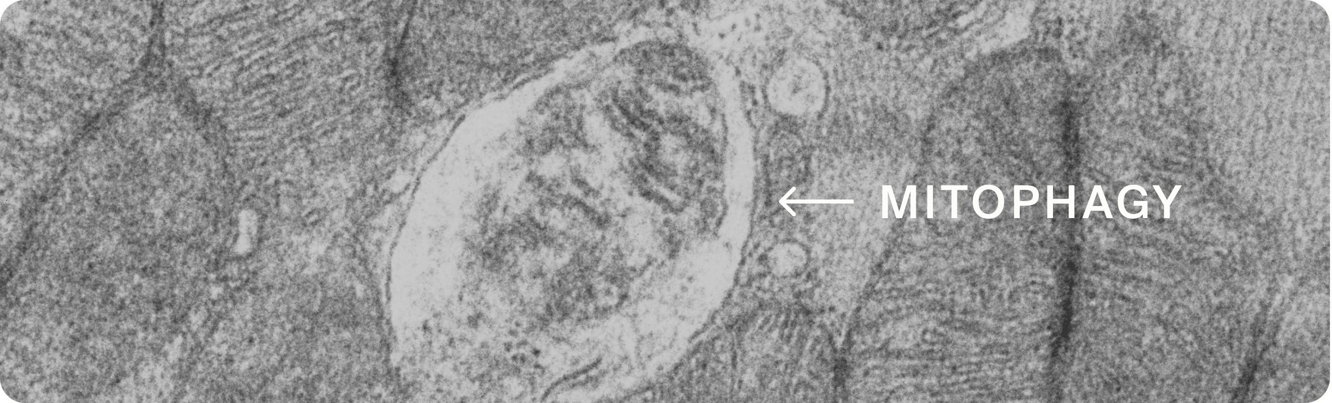MITOPHAGY