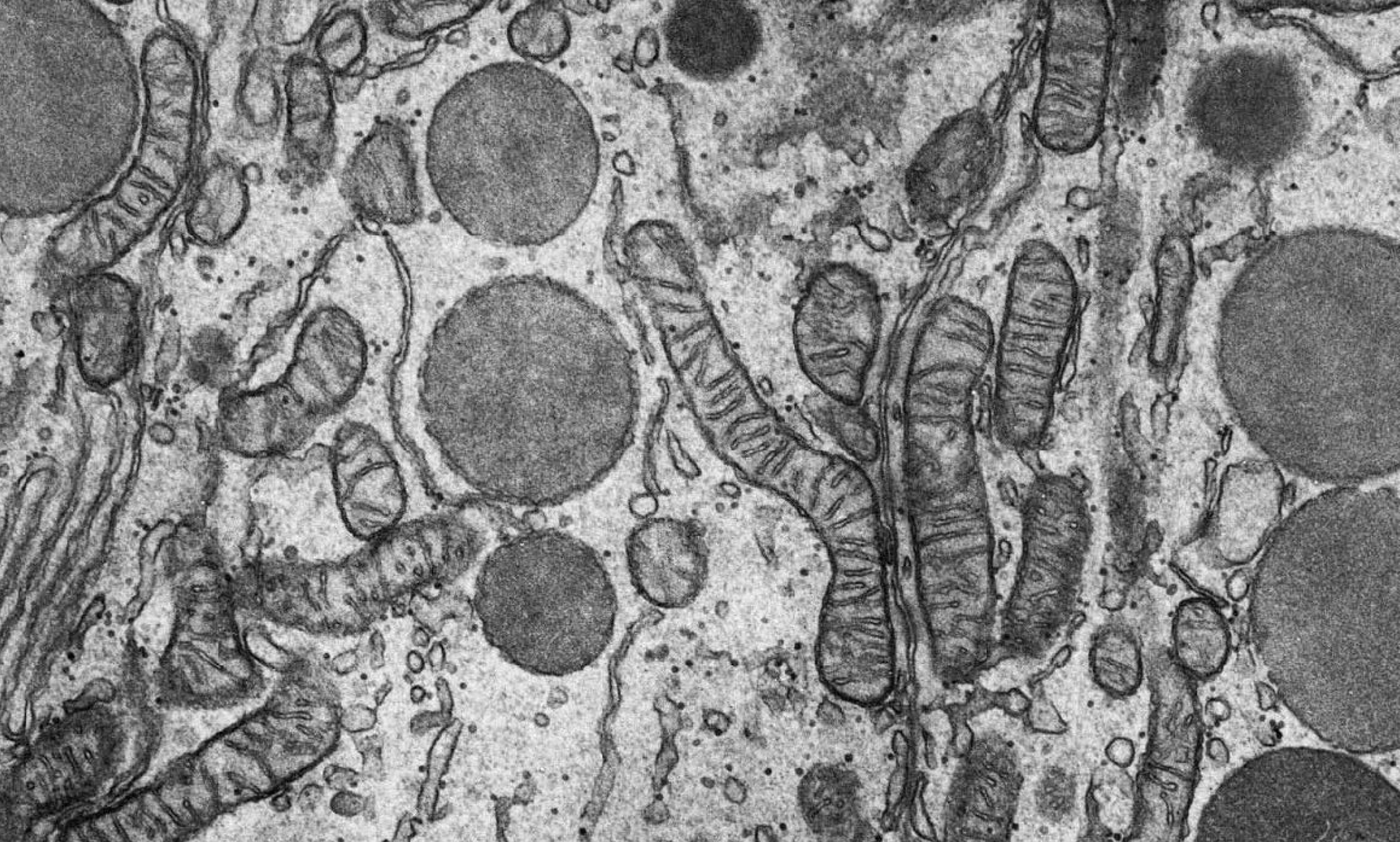 Empty plate and autophagy