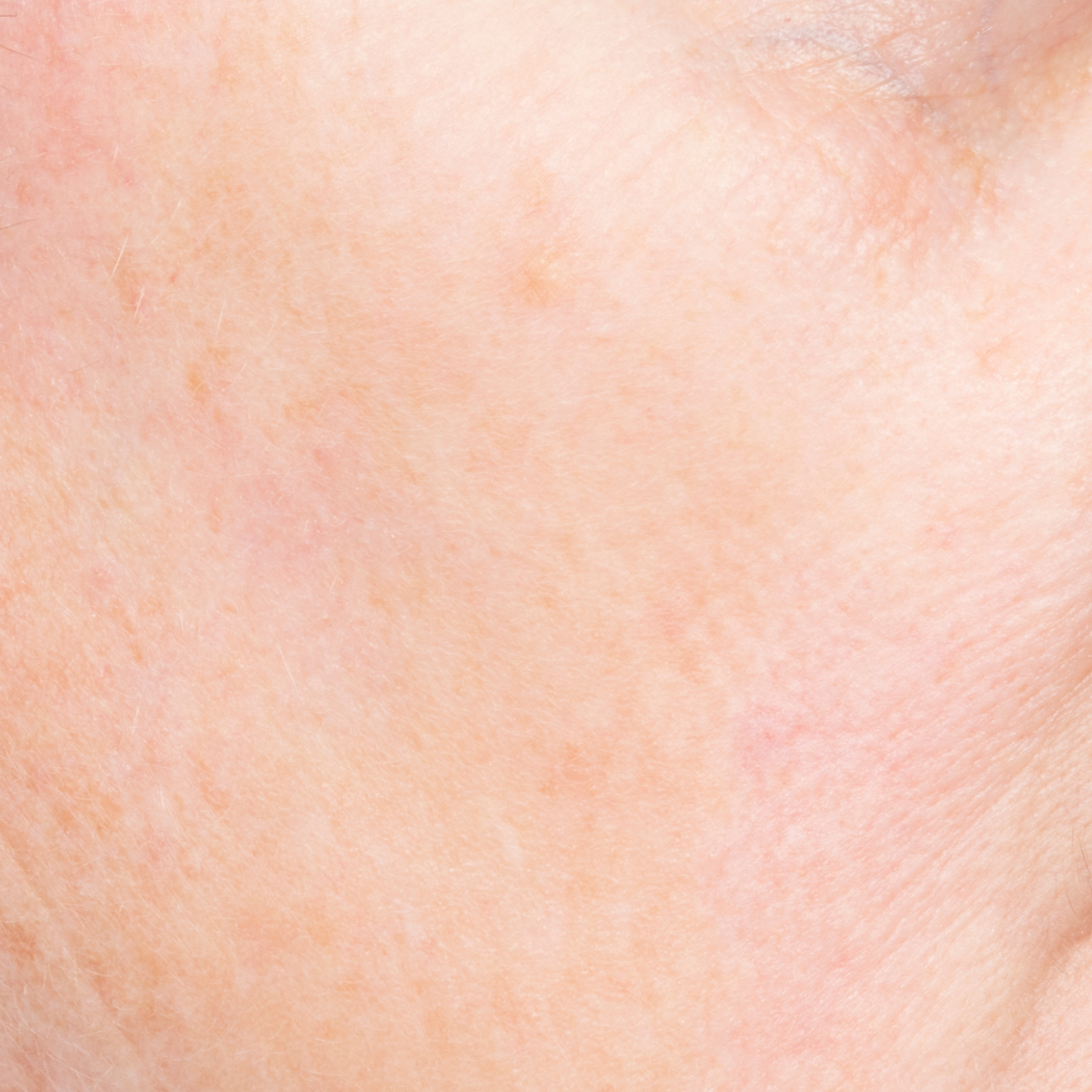 Serum After