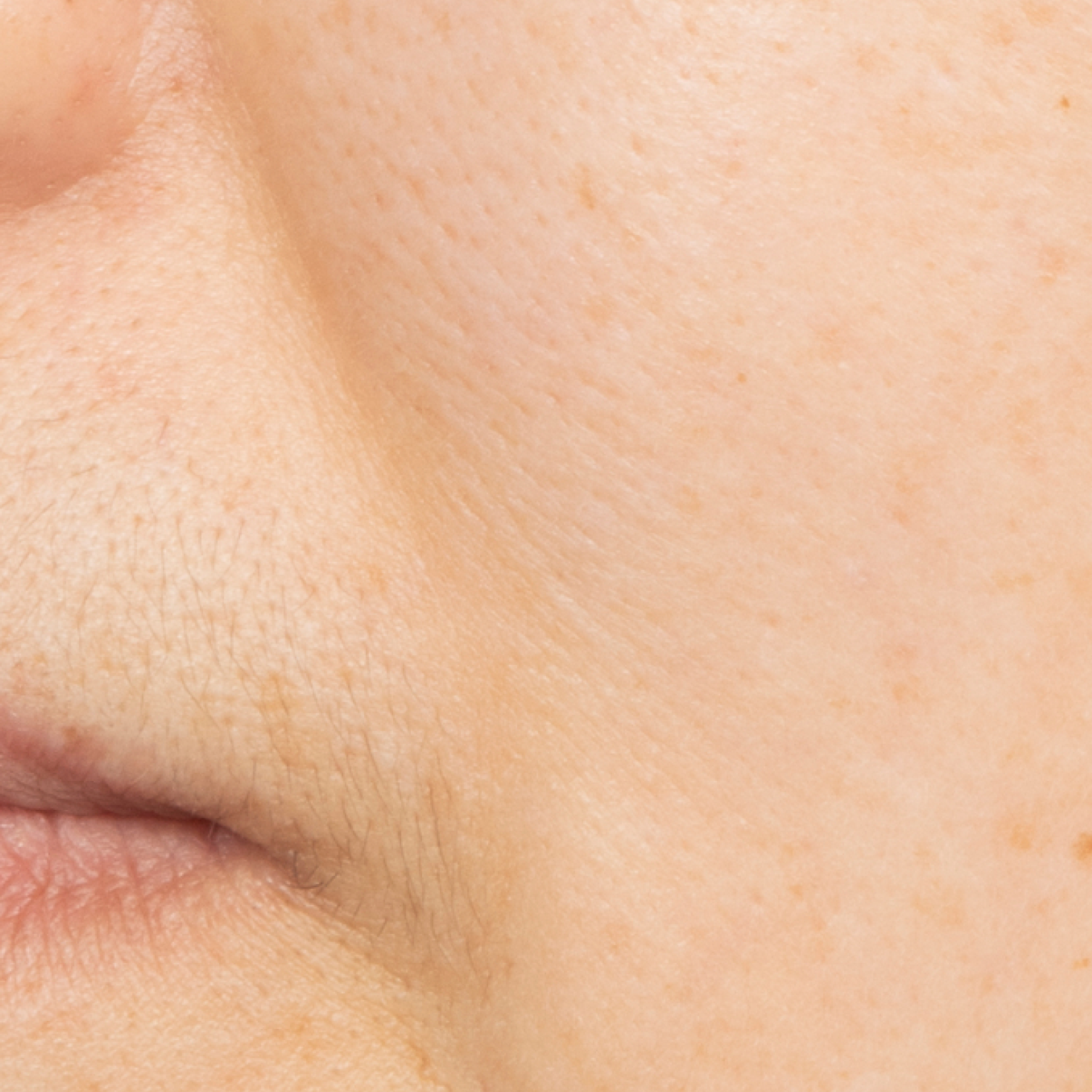 Before Dewy Cream