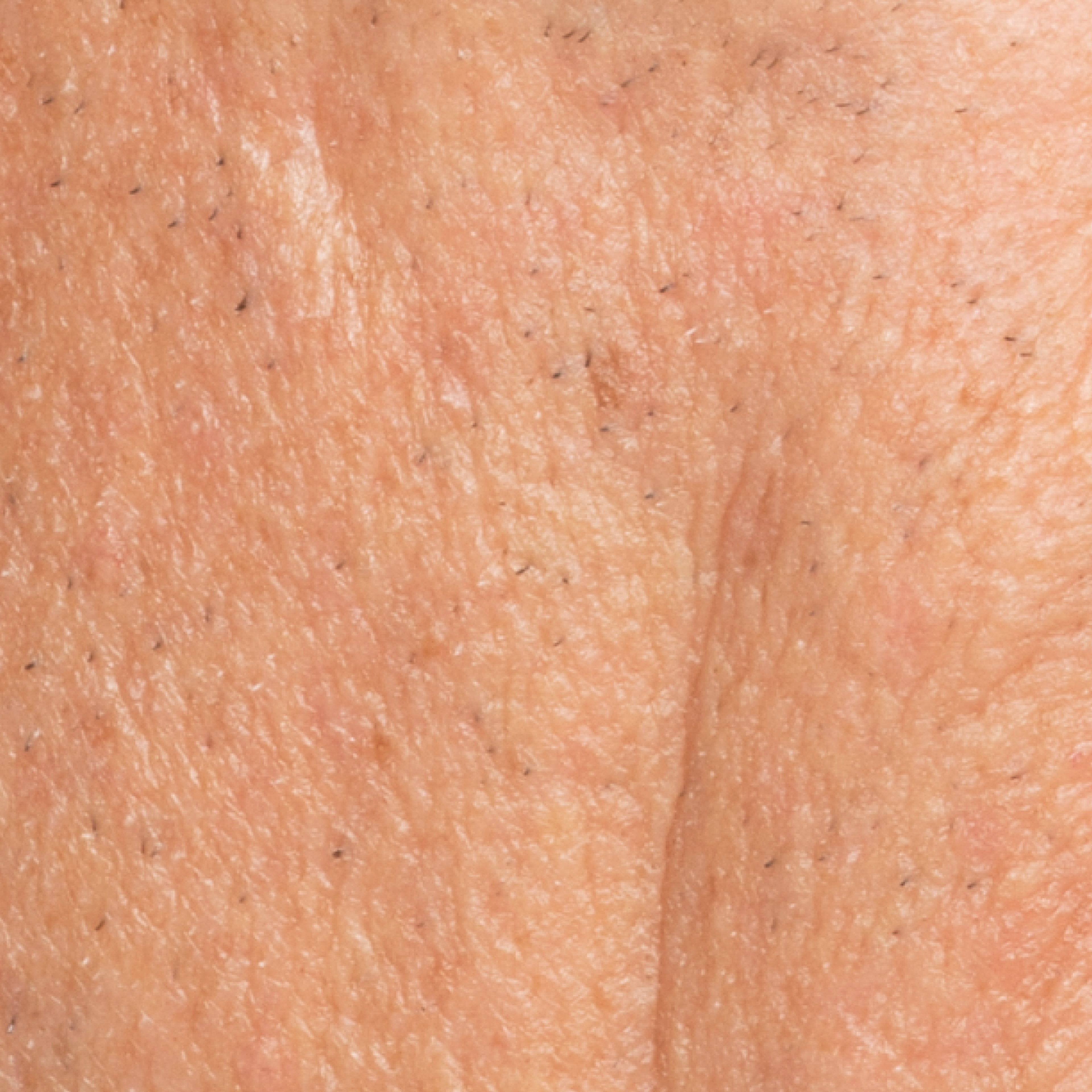 Before Dewy Cream